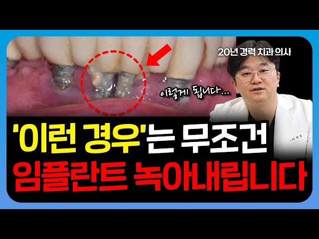 Peri-implantitis: Why Inflammation Is Inevitable and How to Easily Fix It