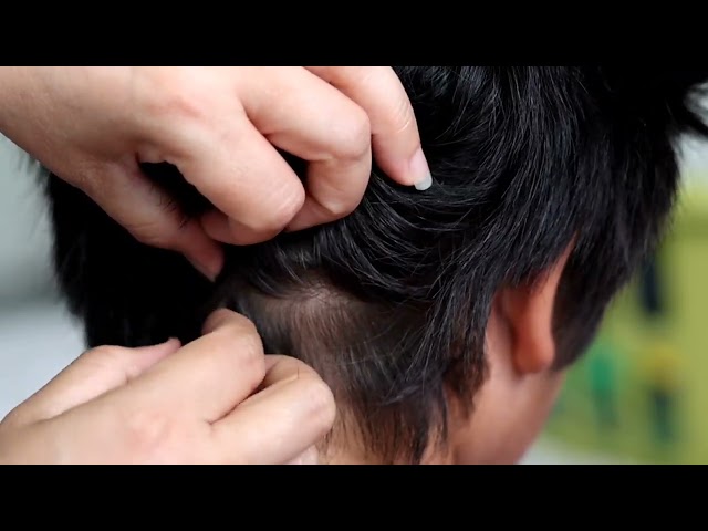 Scratching short hair. 