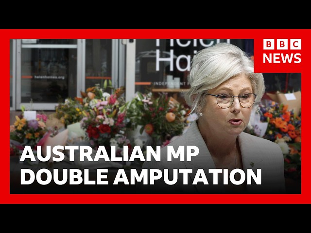 Australian MP loses both legs after alleged car attack | BBC News