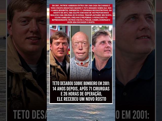 TETO DESABOU SOBRE BOMBEIRO EM 2001: 14 ANOS DEPOIS ELE RECEBEU UM NOVO ROSTO