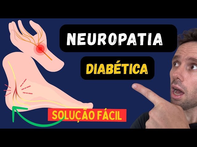 How to relieve burning feet in diabetics (Neuropathy)
