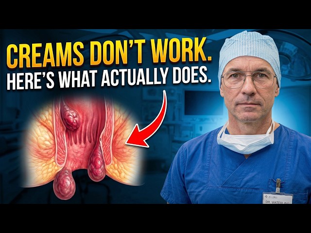 Hemorrhoids Keep Coming Back? Here's What Actually Stops Them