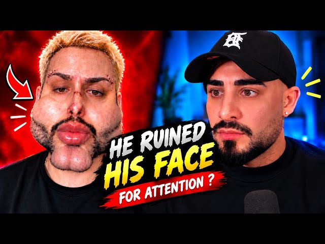 He ruined his face | Bartmann funny videos | Bartmann funny reactions | try not to laugh | comedy 😆 
