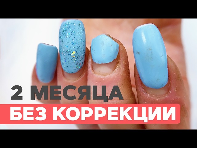 Gel tips