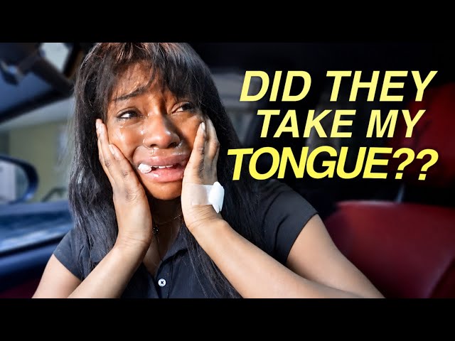 i got all 4 of my wisdom teeth removed…