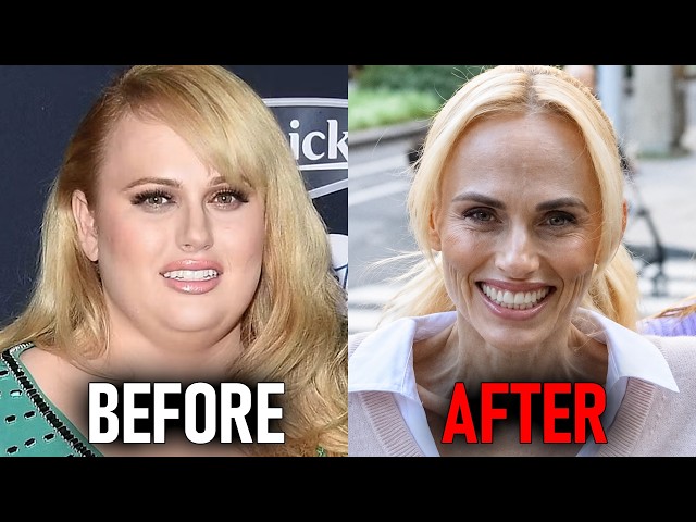 Top 10 Celebrities Who Look Completely Different After Extreme Weight Loss