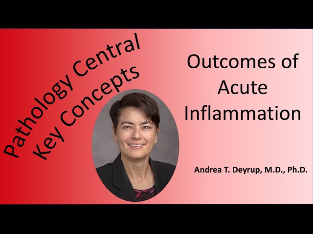 Pathology Central Key Concepts: Outcomes of Acute Inflammation