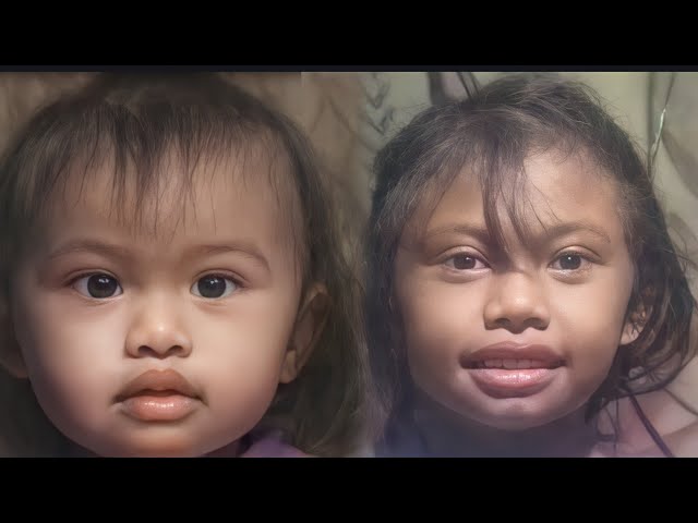 BEFORE AND AFTER |Gingging Cervantes