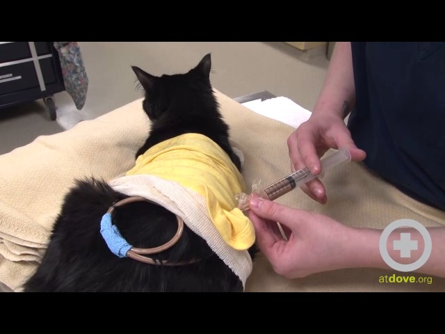 Percutaneous Endoscopic Gastrostomy (PEG) Tube Feeding