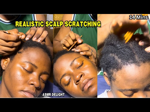 ASMR 💫 Realistic Scalp Scratching