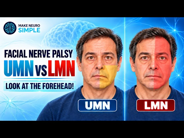 Upper motor neuron 7 vs Lower motor neuron 7