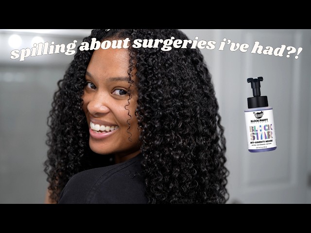 style and spill: no wash quick curly hair refresh + why I had two surgeries?!