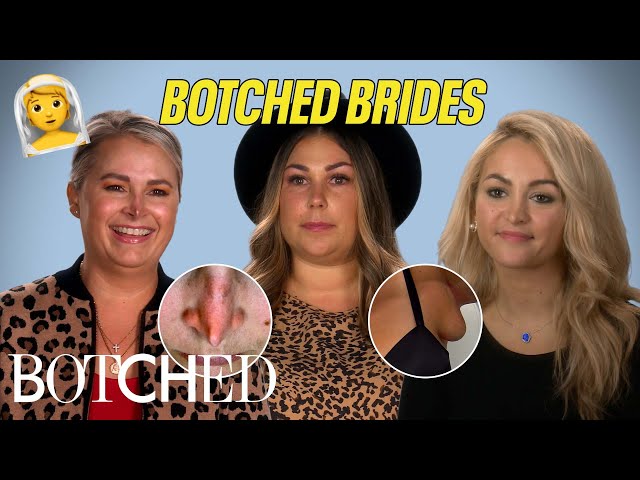 Botched Brides: Pulverized Noses, Extra Breasts and More?! (Before & After) | Botched | E!