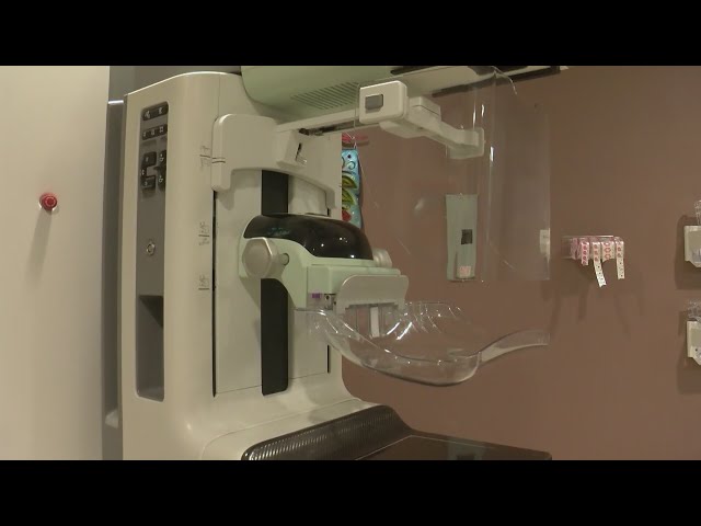 High Resolution: Why women should start annual mammograms by age 40