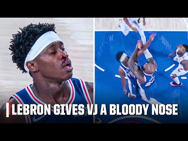 LeBron accidentally hits V.J. Edgecombe in the face giving him a bloody nose | NBA on ESPN