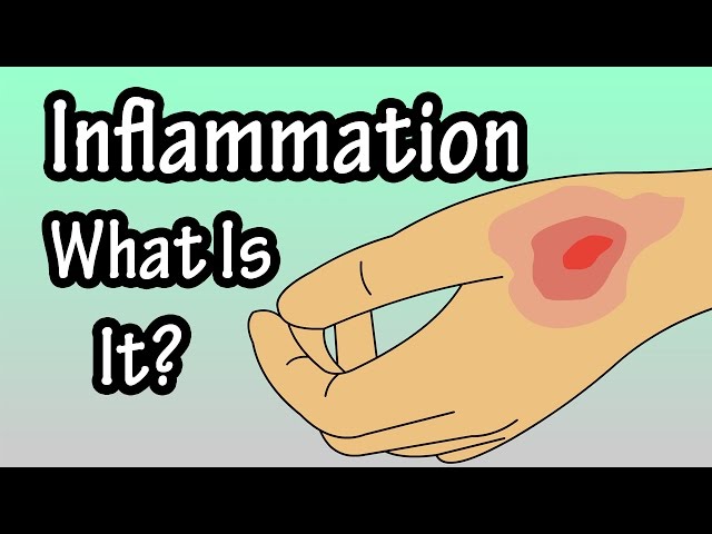 Inflammation - Inflammatory Response - What Is Inflammation In The Body?