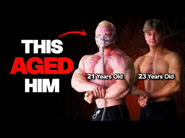 Looksmaxxing With Steroids Is Peak STUPIDITY...