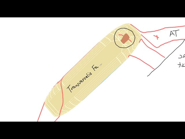 3D Tour of the Inguinal Canal