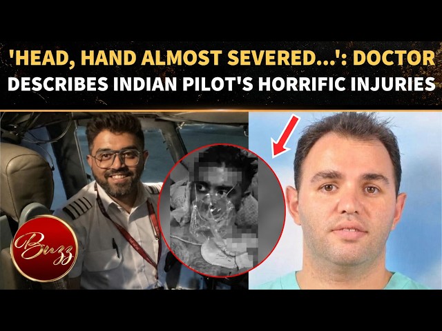 Flydubai HORROR: Doctor’s CHILLING Account Of HERO Indian Pilot’s HORRIFIC Injuries | WATCH