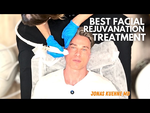 New T Shape 2  💆The Future of Facial Rejuvenation