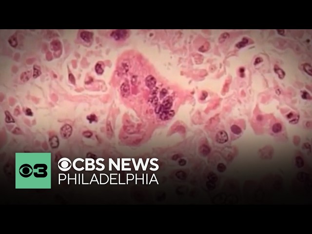 Delaware County launches measles immunization campaign for back-to-school