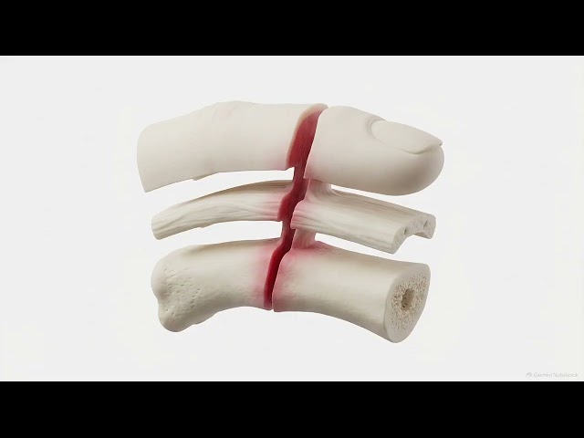 35 Arthritis and Musculoskeletal Infection Imaging