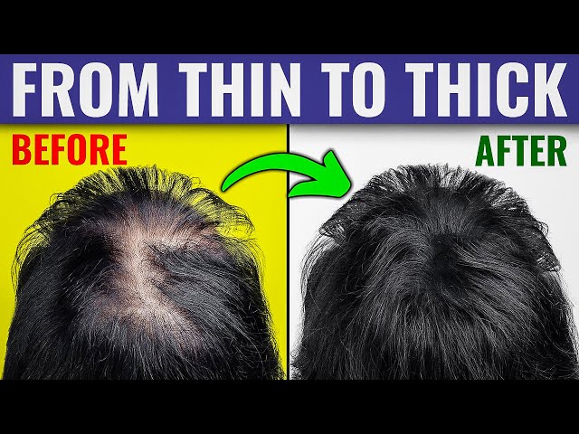 The Ultimate Guide to Thicker Hair – Dr. Berg's Expert Advice
