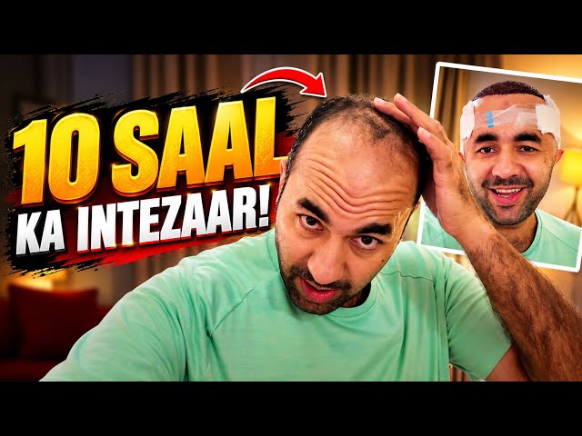 My Hair Transplant in Pakistan | The Full Experience After 10 Years of Waiting