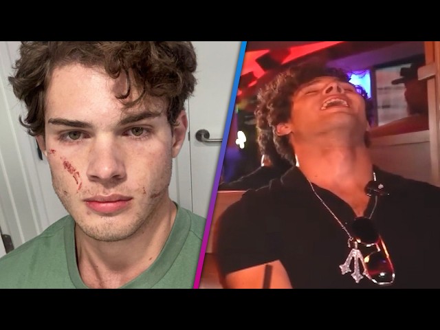 Clavicular Speaks Out After 'Brutal' Overdose on Livestream