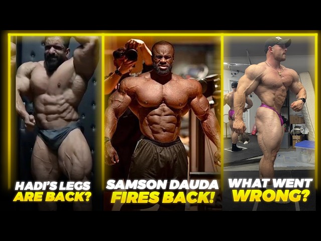 Samson Dauda FIRES BACK + What Really Happened to Martin? + Hadi's Legs ARE BACK? + More