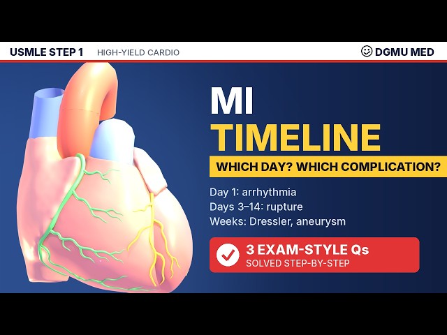 Myocardial Infarction Complications for USMLE Step 1 | MI Timeline, Rupture, Dressler + 3 Questions