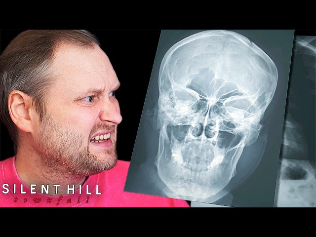 SURGEON SIMULATOR ► Silent Hill: Townfall #6