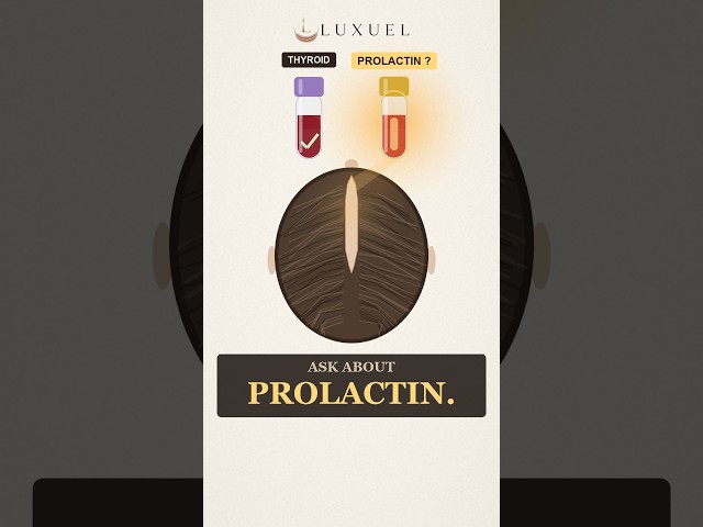 Can high prolactin cause hair loss?