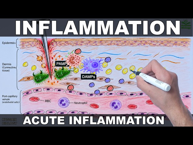 Inflammation | Mechanism of Acute Inflammation