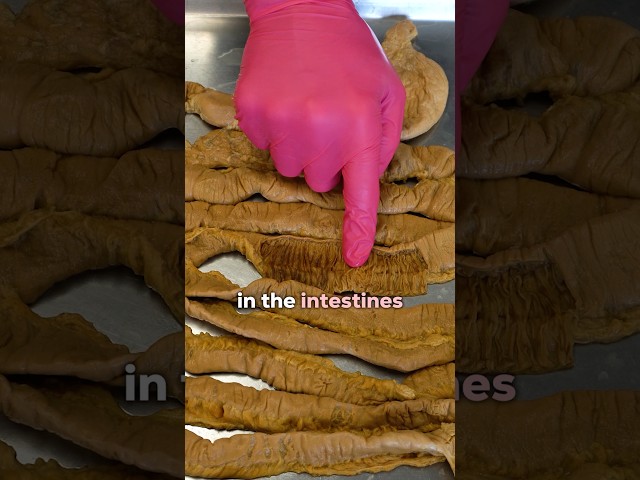 Hormones That Affect Hunger