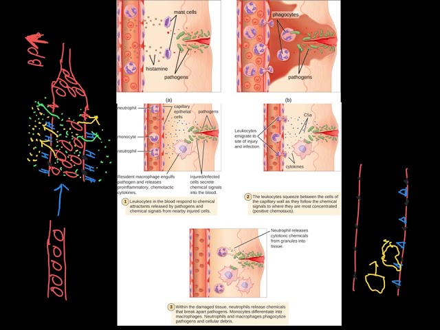Inflammation