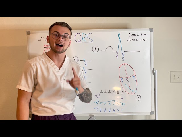 EKG Series: QRS Complex and Chest Lead Progression