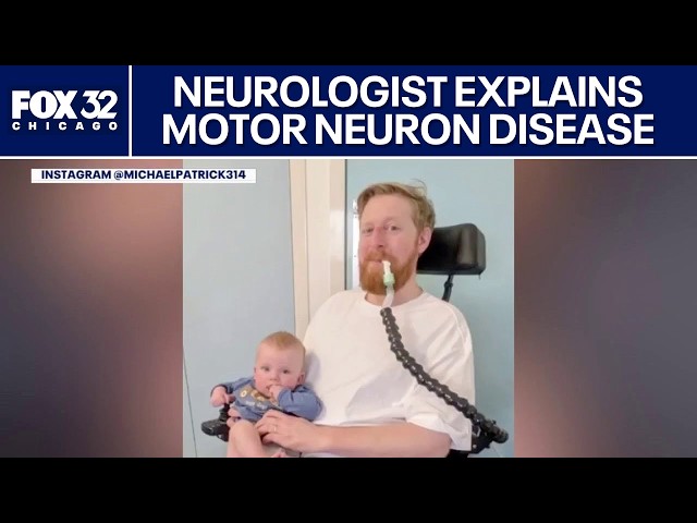 Neurologist explains motor neuron disease after Game of Thrones actor’s death at 35
