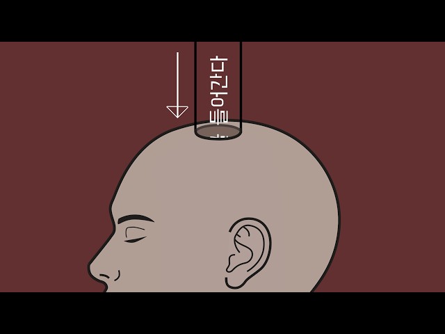 Warning⚠️ Injecting Tingles Into Brain ㅣ ASMR