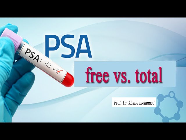 Prostate specific antigen (PSA). Free vs. total