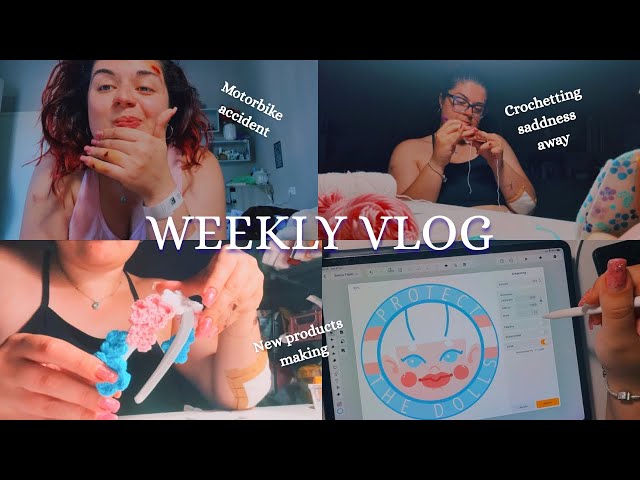 WEEKLY VLOG | Working two jobs while following passions in my ART journey + Motorbike Accident
