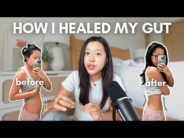 How fixing my GUT HEALTH changed my life | bloating, acne, fatigue