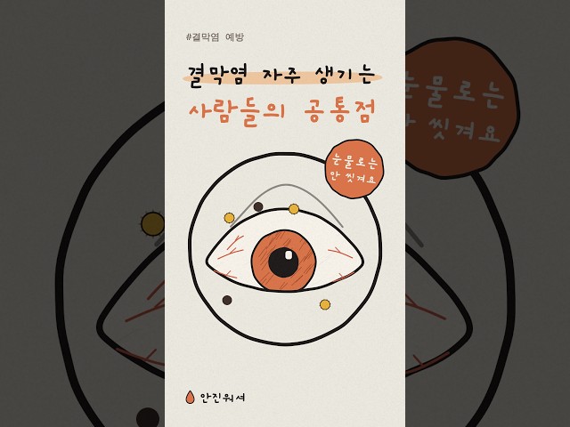 결막염 자주 생기는 사람들의 공통점