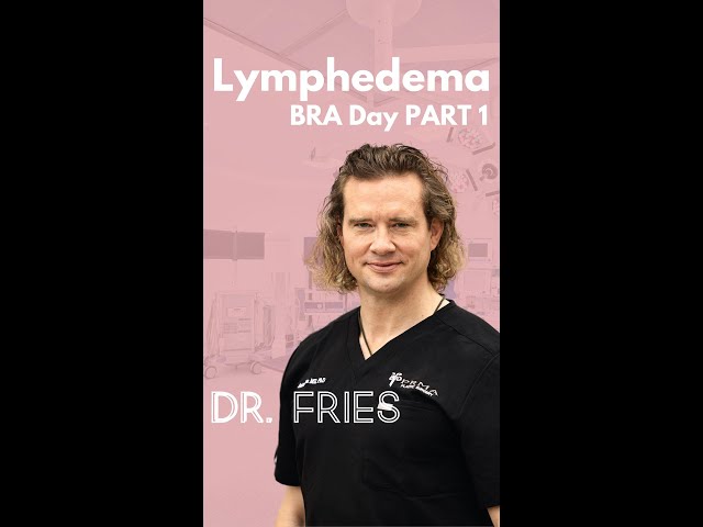 What is lymphedema?