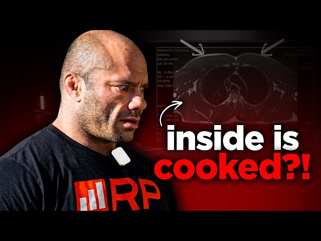 Mike Israetel Got His Bubble Gut Scanned…