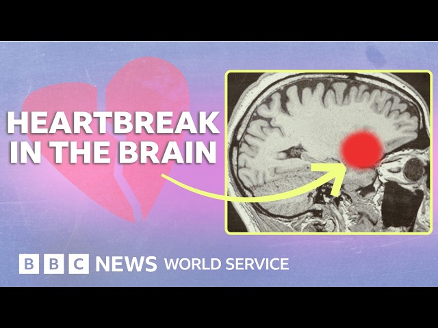 How love and heartbreak rewire your brain - BBC World Service