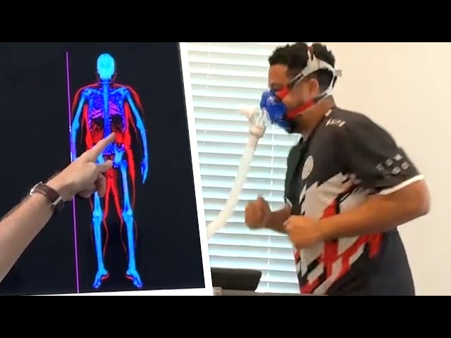 My DEXA Scan Results Are Concerning…
