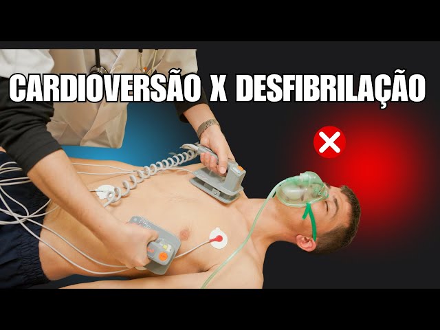 Synchronized Electrical Cardioversion or Defibrillation? How to treat a tachyarrhythmia?