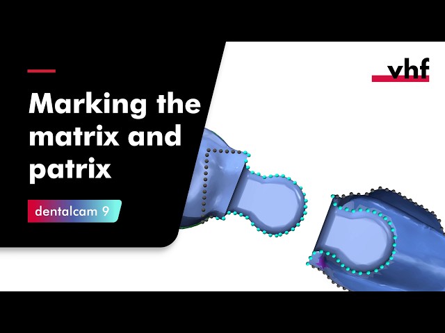 dentalcam 9 – Marking the matrix and patrix
