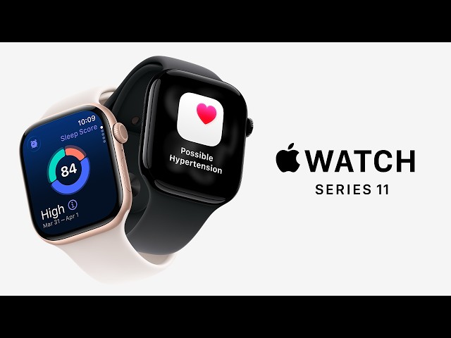 Apple Watch Series 11: The ultimate way to watch your health